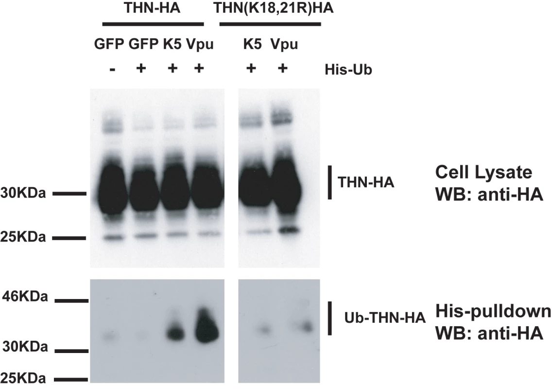 Tetherin cytoplasmic tail lysine residues are ubiquitinated in the presence of K5 and Vpu.