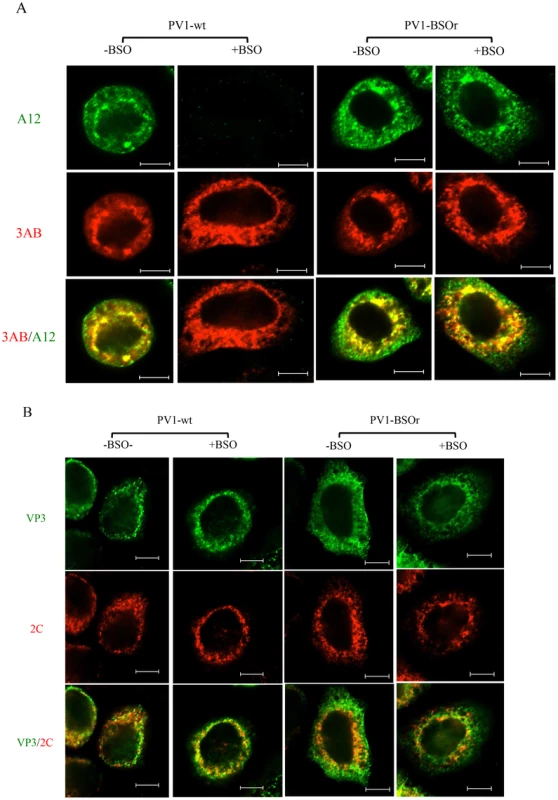 Immunofluorescence cell imaging of PV1-infected HeLa cells in the presence and absence of BSO.