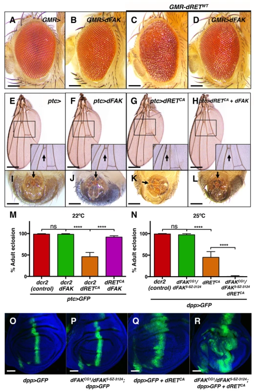 FAK suppresses RET-driven effects in different fly tissues.