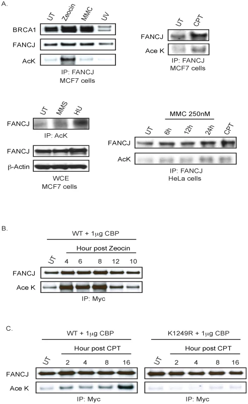 FANCJ acetylation is induced after DNA damage.