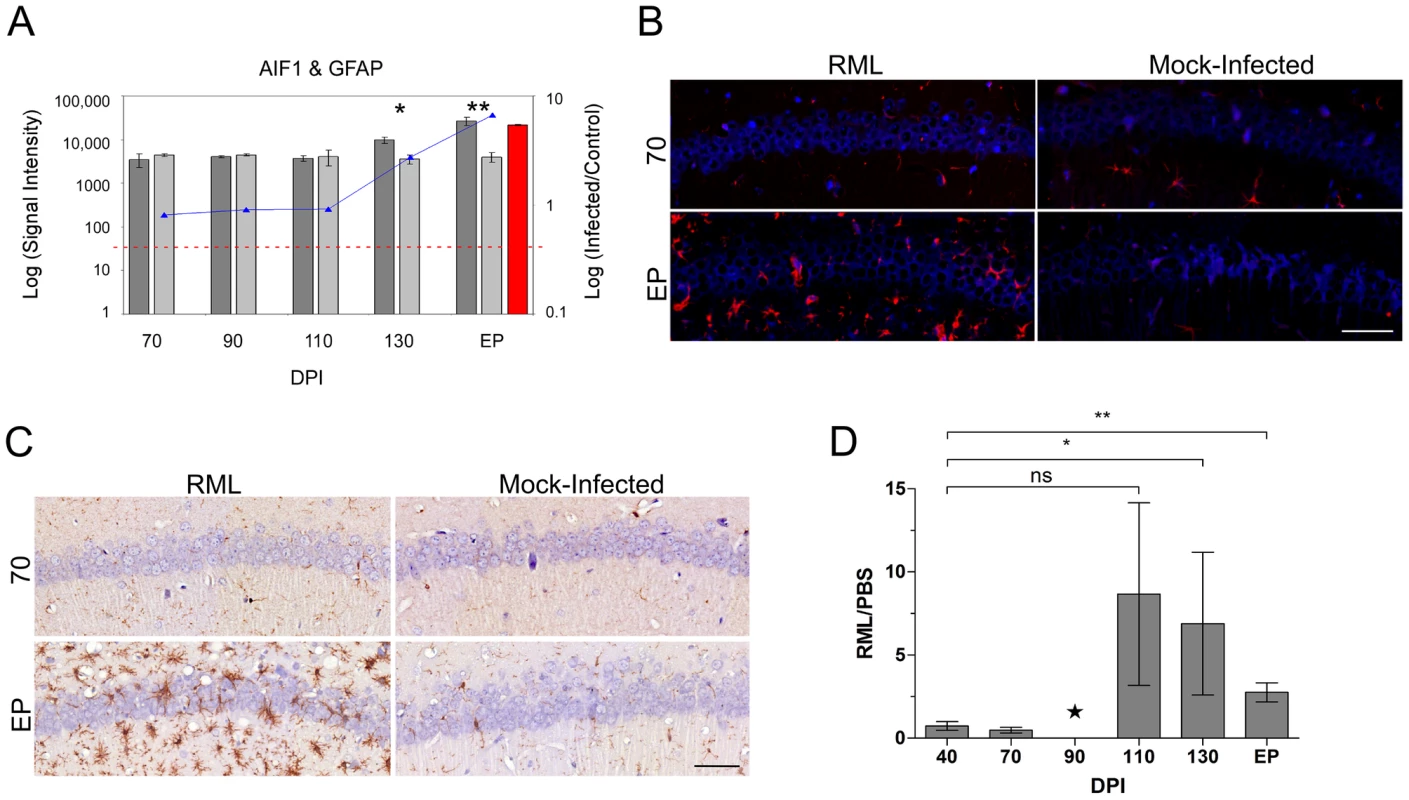 The distribution of resident immune cells in the CA1 hippocampal region of both control and prion infected mice.