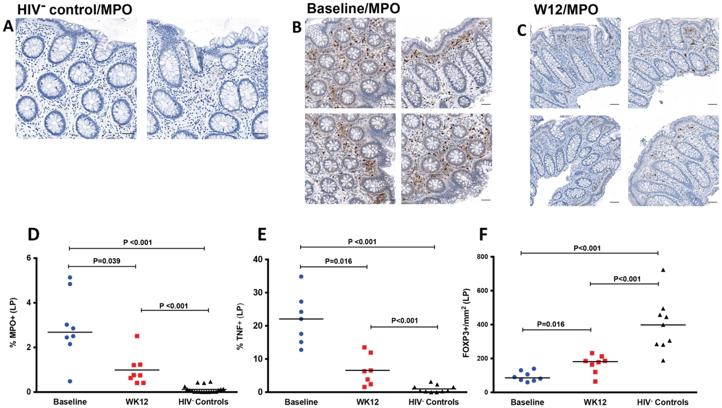 Decreased neutrophil infiltration by myeloperoxidase (MPO) staining, decreased TNF and increased FOXP3 in LP at week 12 after r-hIL-7 administration.