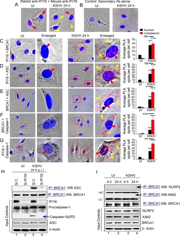 PLA and knockdown studies demonstrating specificity of BRCA1 interactions with IFI16-inflammasome components and relocalization to the cytoplasm during <i>de novo</i> KSHV infection.