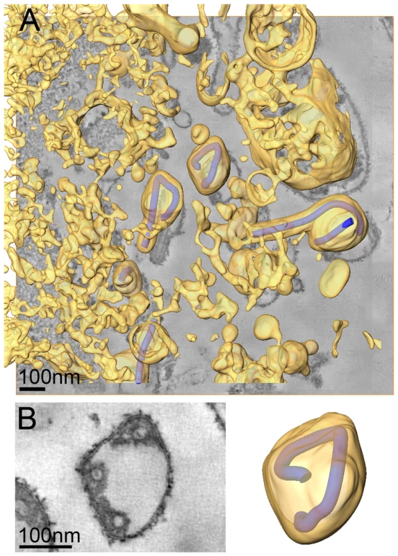 Release and spherical morphology of MARV particles after prolonged infection.