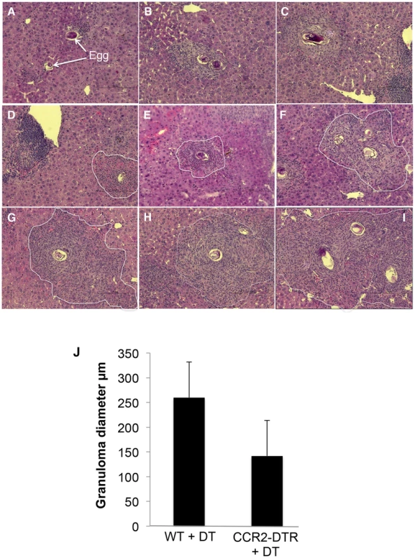 Depletion of monocytes results in reduced granuloma formation.
