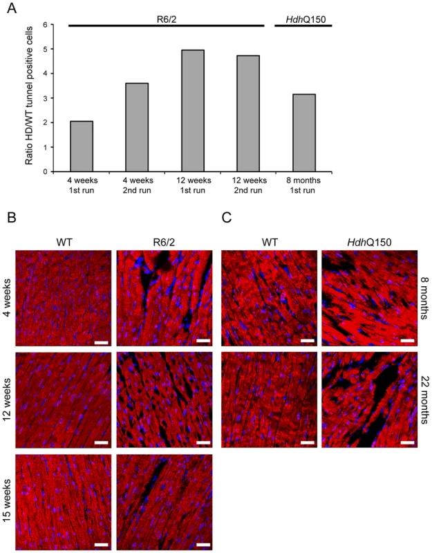 Ongoing cardiomyocyte death occurs through apoptosis in the hearts of HD mouse models.