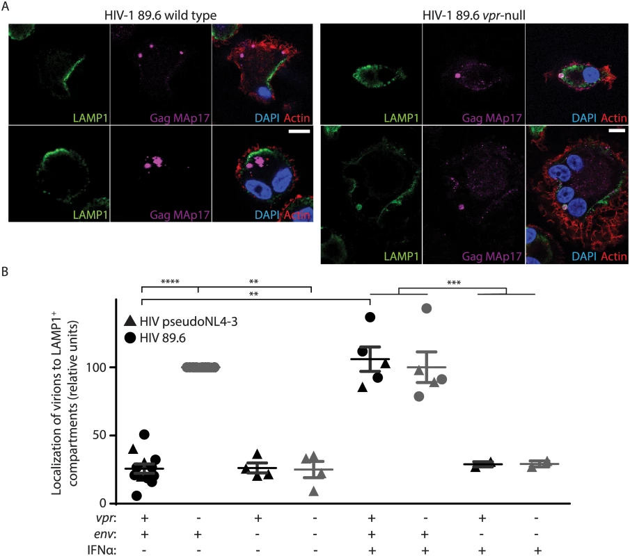 Vpr counteracts Env-dependent targeting of HIV-1 virions to lysosomes in macrophages.