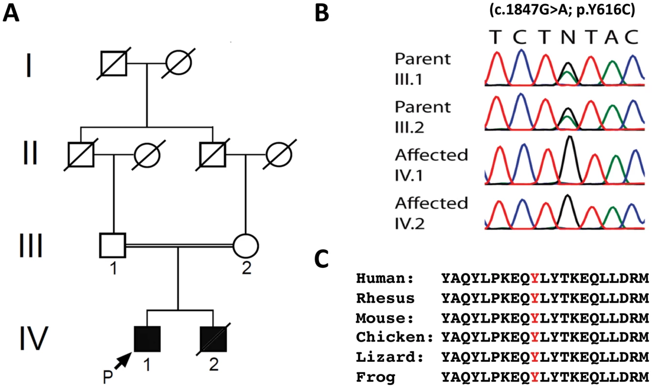 Genetic analysis of family with early onset spastic ataxia-neuropathy syndrome.