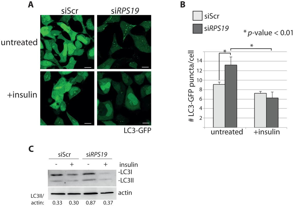 Insulin abolishes autophagy in cells with RPS19 loss.