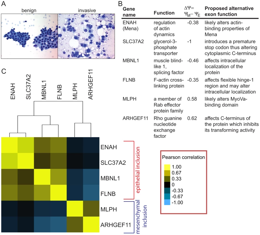 Alternative mRNA isoforms are expressed in FNA samples from breast cancer patients.