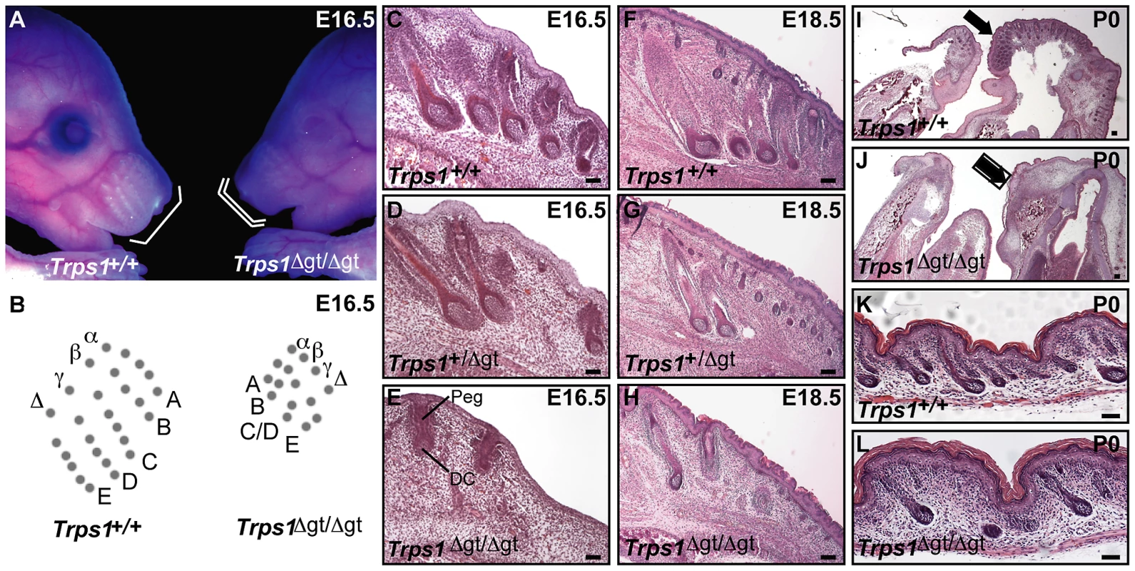 Late morphogenesis vibrissa follicle abnormalities in <i>Trps1<sup>Δgt/Δgt</sup></i> embryos.