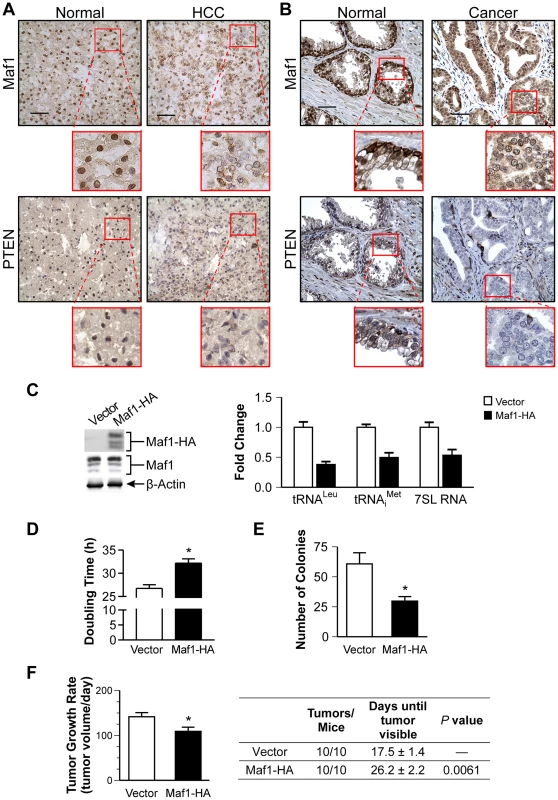 Increased Maf1 expression suppresses cellular transformation and tumorigenesis, consistent with its diminished expression in human cancer tissues.