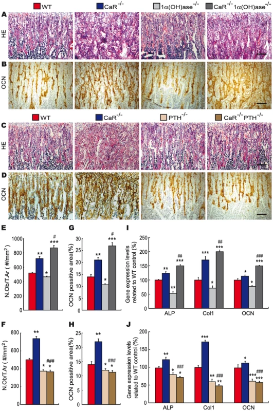 Effects of deletion of 1α(OH)ase or PTH on osteoblastic bone formation in CaR–deficient mice.