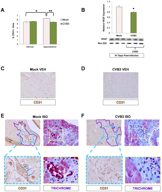 Impaired vascular remodeling following beta-adrenergic stimulation-induced cardiac hypertrophy in adult mice infected with CVB3 at an early age.