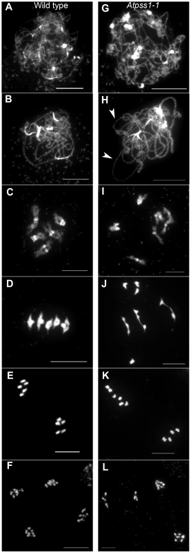 Chromosome spreads of male meiocytes in wild type and <i>Atpss1-1</i>.