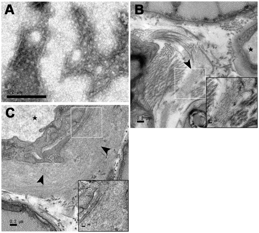 Transmission electron microscopy images of amyloid fibrils deposited in muscles.