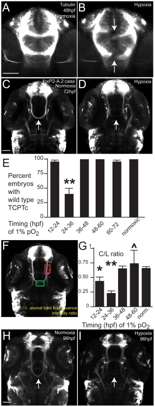 Hypoxia disrupts axon pathfinding in the developing CNS.