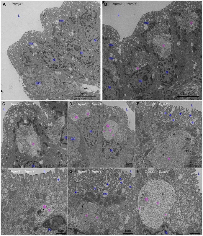 Formation of pathological vacuolar organelles in neonatal enterocytes lacking both mucolipins 1 and 3.