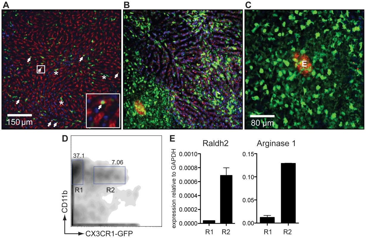 CX<sub>3</sub>CR1-GFP<sup>+</sup> AAMφ in the liver granulomas of <i>S. mansoni</i> infected mice express Raldh2.