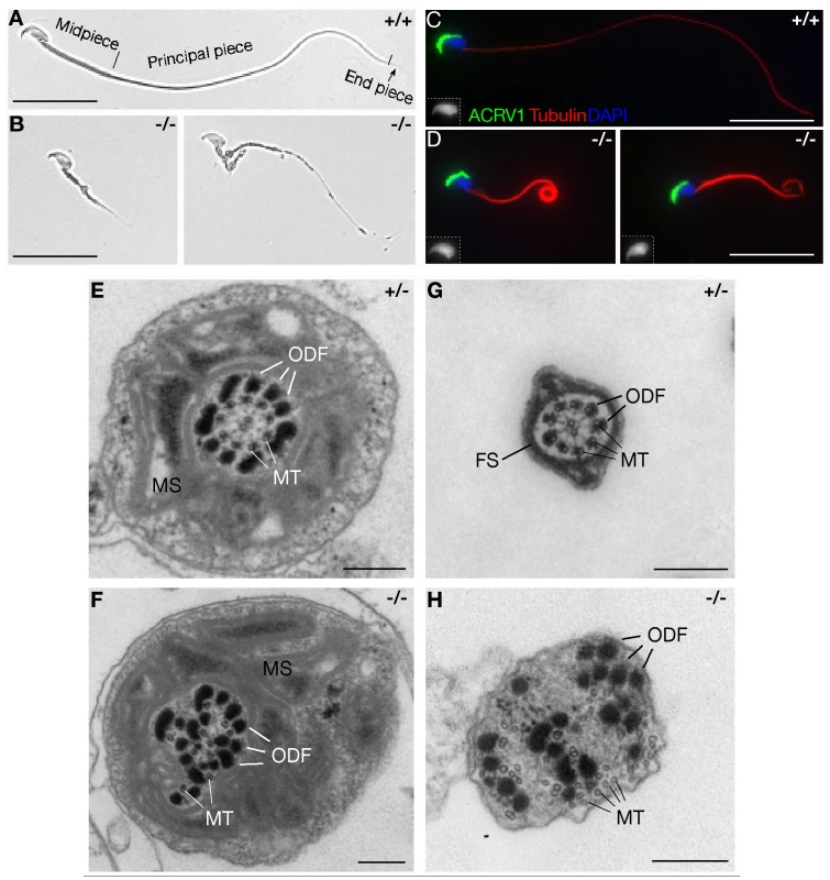 MNS1 is essential for the assembly of sperm flagella.