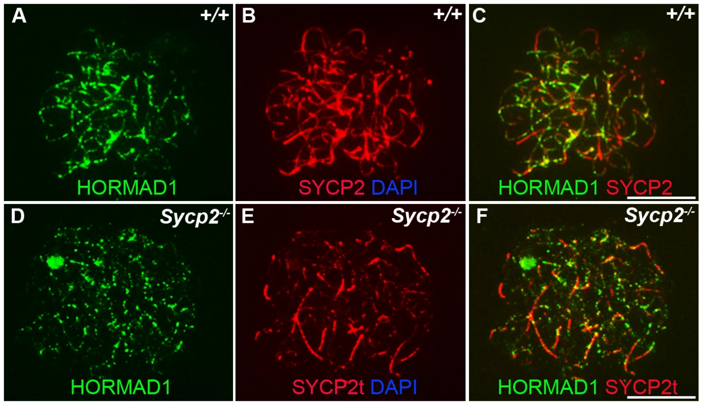 HORMAD1 localization in <i>Sycp2</i> mutant spermatocytes.
