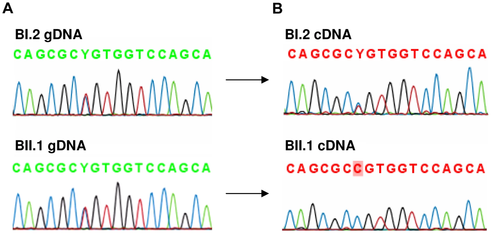 Analysis of rs4851214 which maps to coding exon 14 of <i>AFF3</i> using paired genomic DNA and cDNA templates from the unaffected carrier mother BI.2 and the affected carrier son BII.1 from family B.