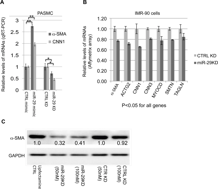 miR-29 promotes the expression of contractile SMC markers.