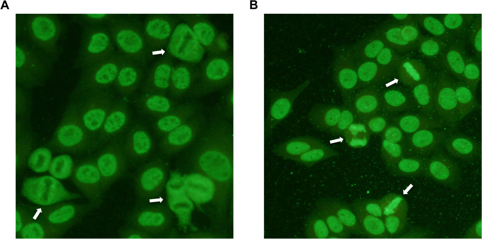Indirect immunofluorescence staining of HEp-2 cells treated with serum from patient dogs.
