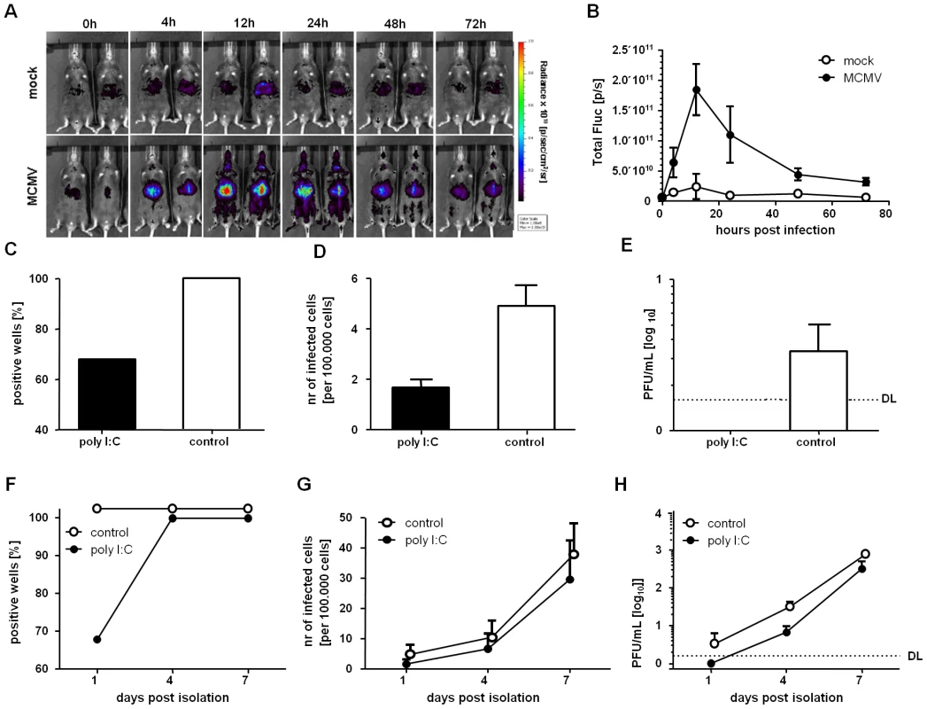 IFNβ stimulation <i>in vivo</i> induce a reversible silencing of MCMV in LSECs.