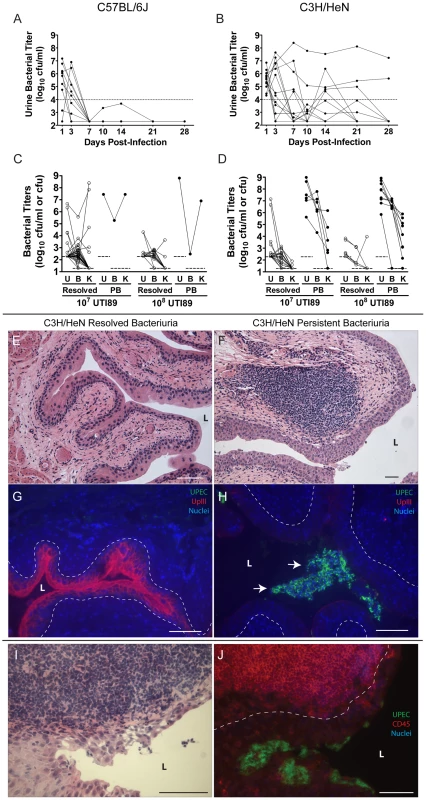 C3H/HeN mice develop chronic cystitis in response to UPEC infection in an infectious dose-dependent manner.