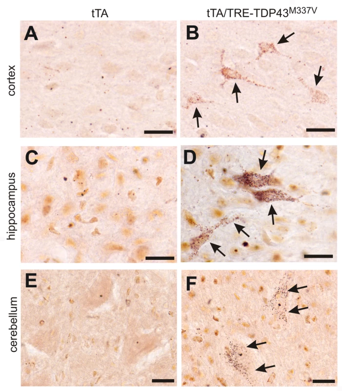 Degeneration of non-motor neurons in paralyzed mutant <i>TDP</i> transgenic rats.