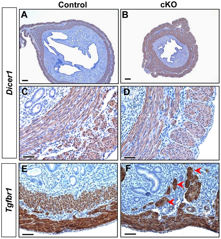 Distinct uterine phenotypes between <i>Dicer1</i> cKO and <i>Tgfbr1</i> cKO mice.