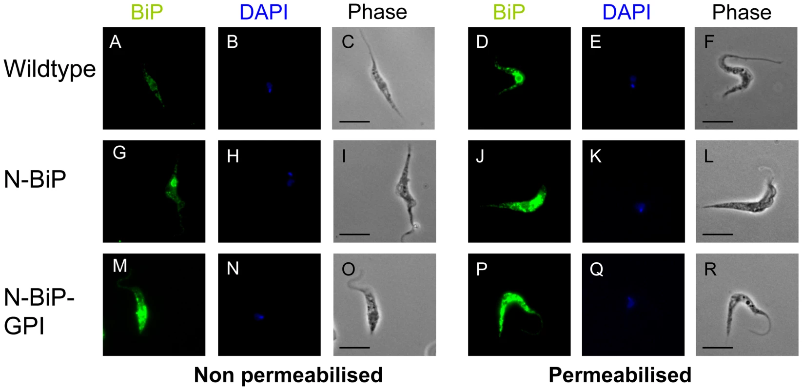 Cellular location of expressed N-BiP and N-BIP-GPI fusion proteins.
