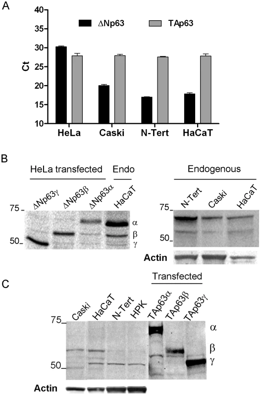Levels of expression of endogenous p63 isoforms in four keratinocyte cell lines.