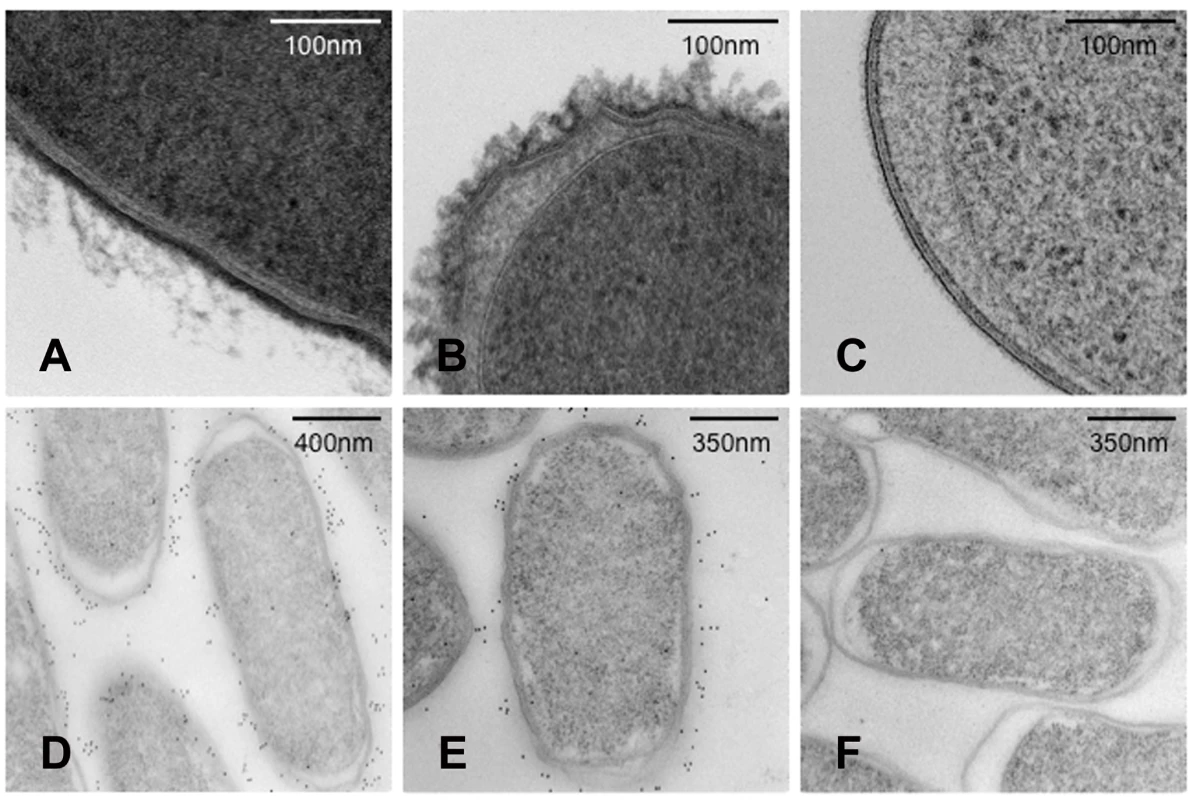 Transmission electron microscopy (TEM) images of <i>S.</i> Typhi and <i>S.</i> Typhimurium showing expression of Vi polysaccharide.
