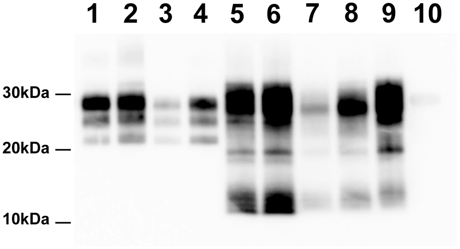 PrP<sup>Sc</sup> Western Blot detection in sheep and <i>tg338</i> mice inoculated with Atypical/Nor98 scrapie and classical scrapie tissues (10% tissue homogenate).