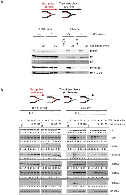 Hat1 is required for the acetylation of histones H3 and H4 deposited during replication-coupled chromatin assembly.