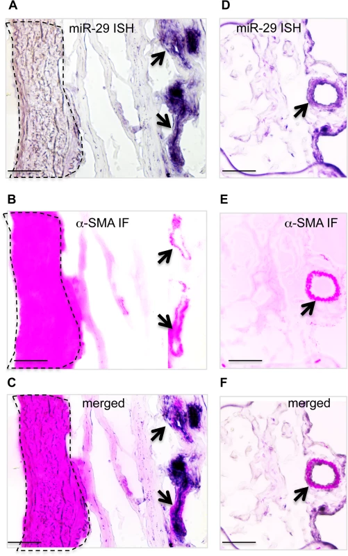 Expression of miR-29 in human lung vasculature.