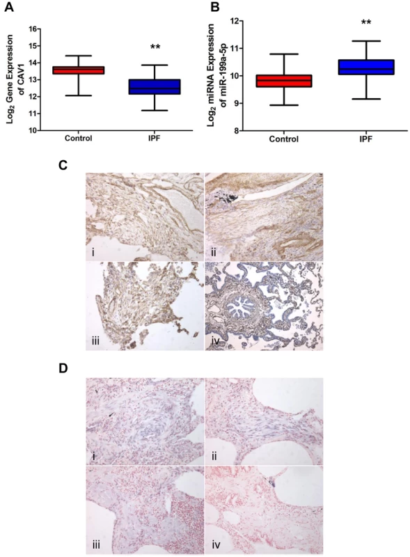 miR-199a-5p and its target CAV1 are dysregulated in IPF.