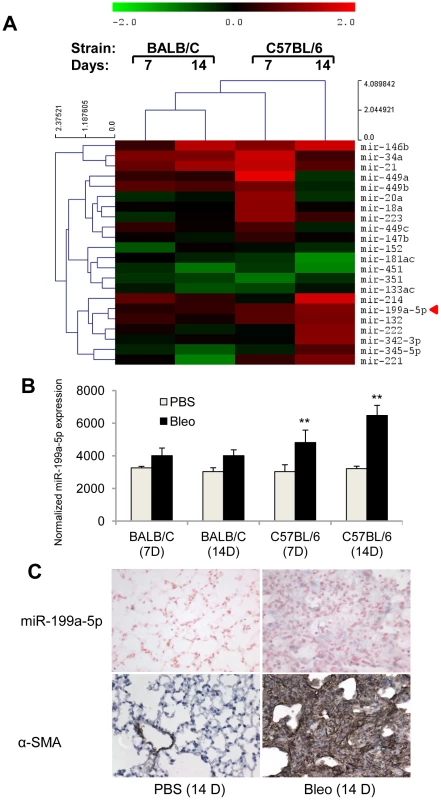 miR-199a-5p expression during bleomycin induced lung fibrosis.