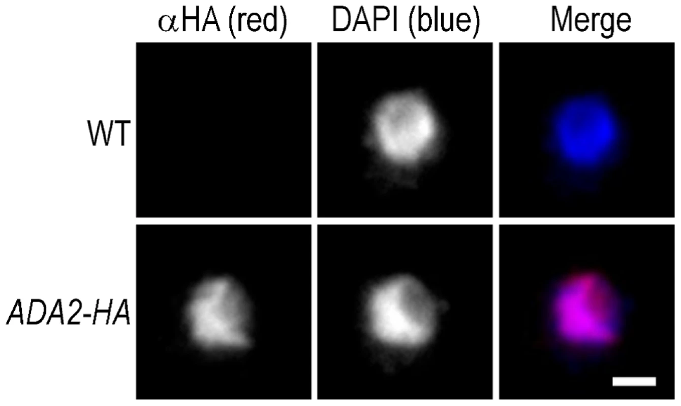 Cryptococcal Ada2 is localized to the nucleus.