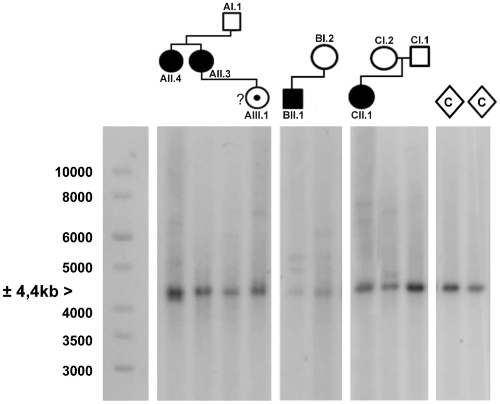 Southern blot analysis of the <i>AFF3</i> CGG repeat in all available members of the three families and two unrelated control individuals (C).