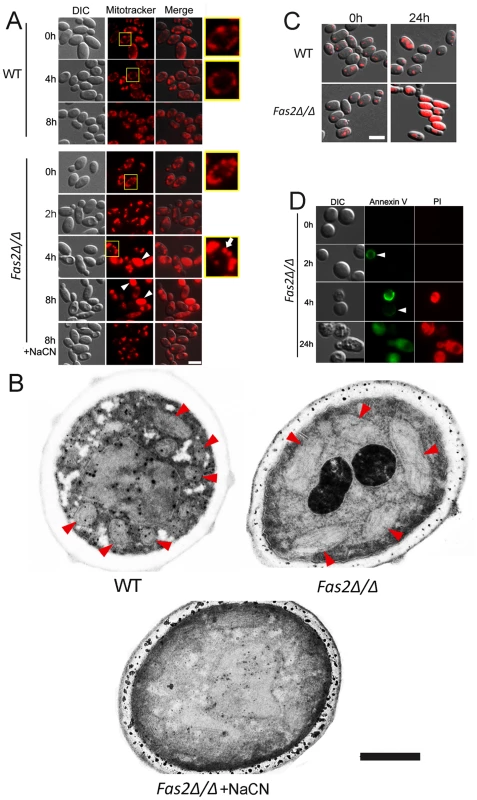 The death of <i>Fas2Δ/Δ</i> yeast cells in serum is mediated via mitochondria.