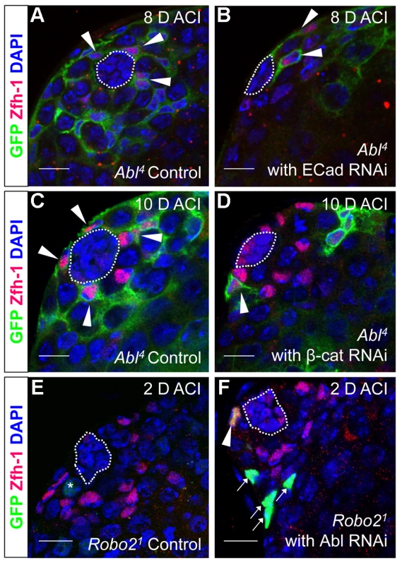 Robo2 and Abl alter cell-cell adhesion to control CySC maintenance.