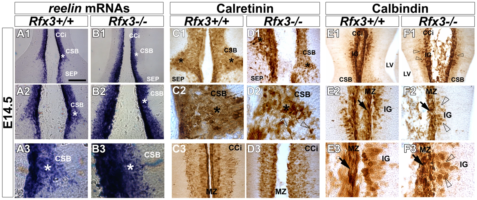 Aberrant localization of midline neurons before CC formation at E14.5.
