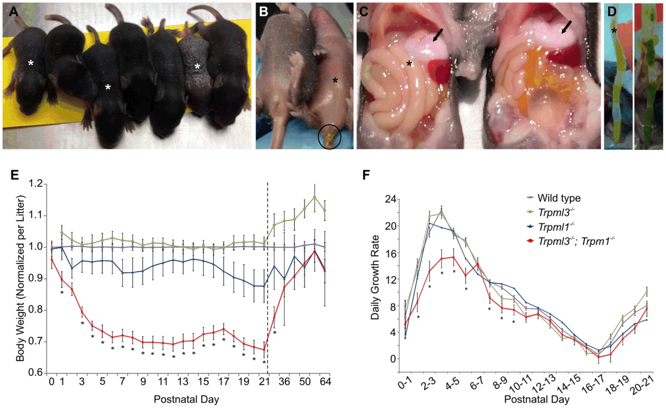 Failure to thrive of suckling mice lacking mucolipins 3 and 1.
