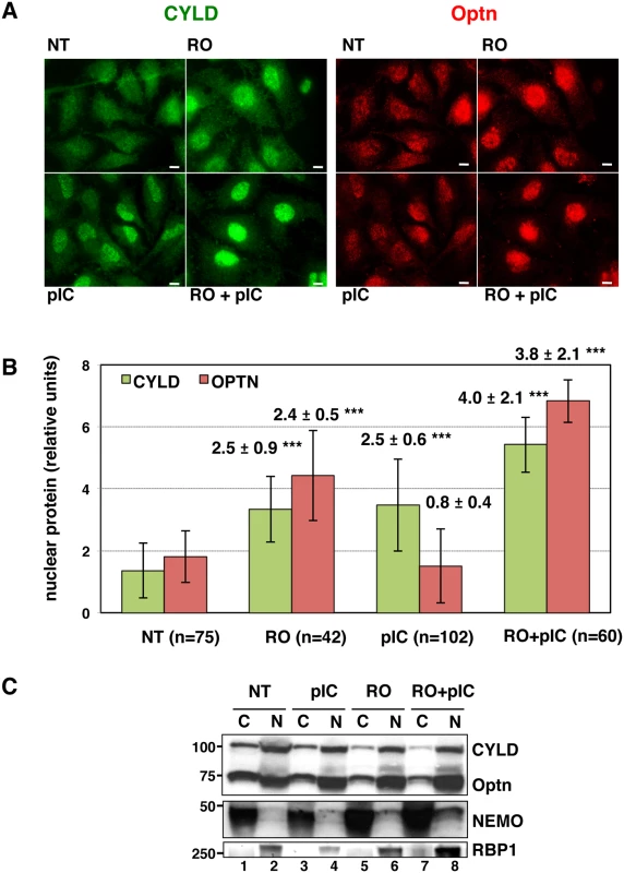 CYLD and Optn accumulate in the nuclei of G2/M synchronized cells.