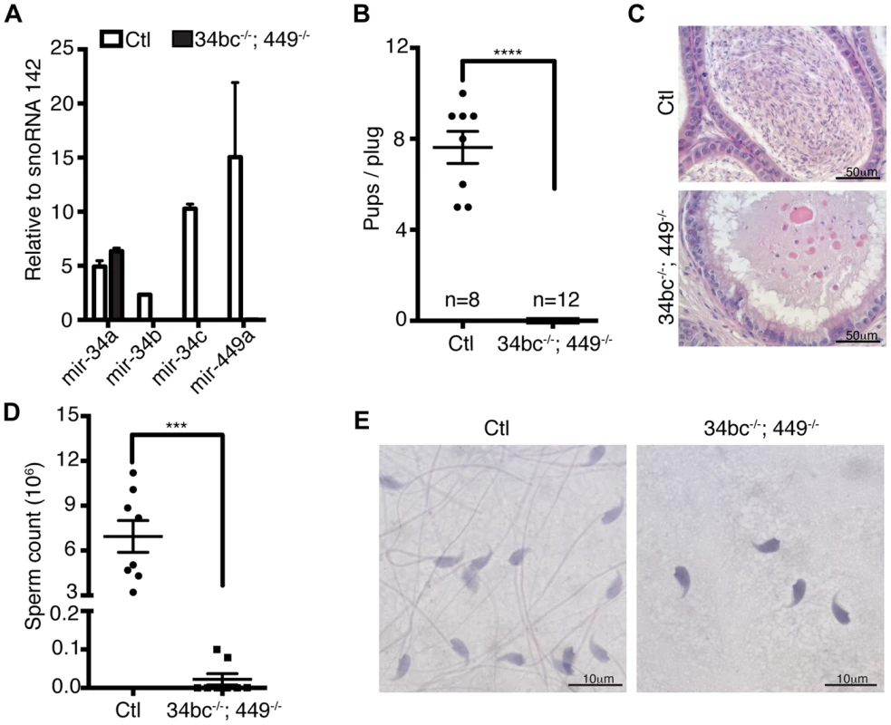 Oligoasthenoteratozoospermia and infertility in miR-34bc<sup>−/−</sup>;449<sup>−/−</sup> mice.