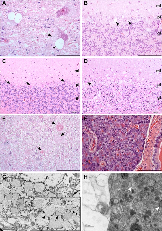 Histological findings in neurons and pancreas.