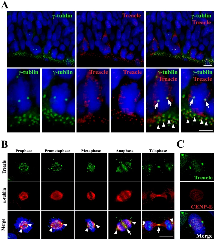 Dynamic localization of Treacle in mitotic cells.
